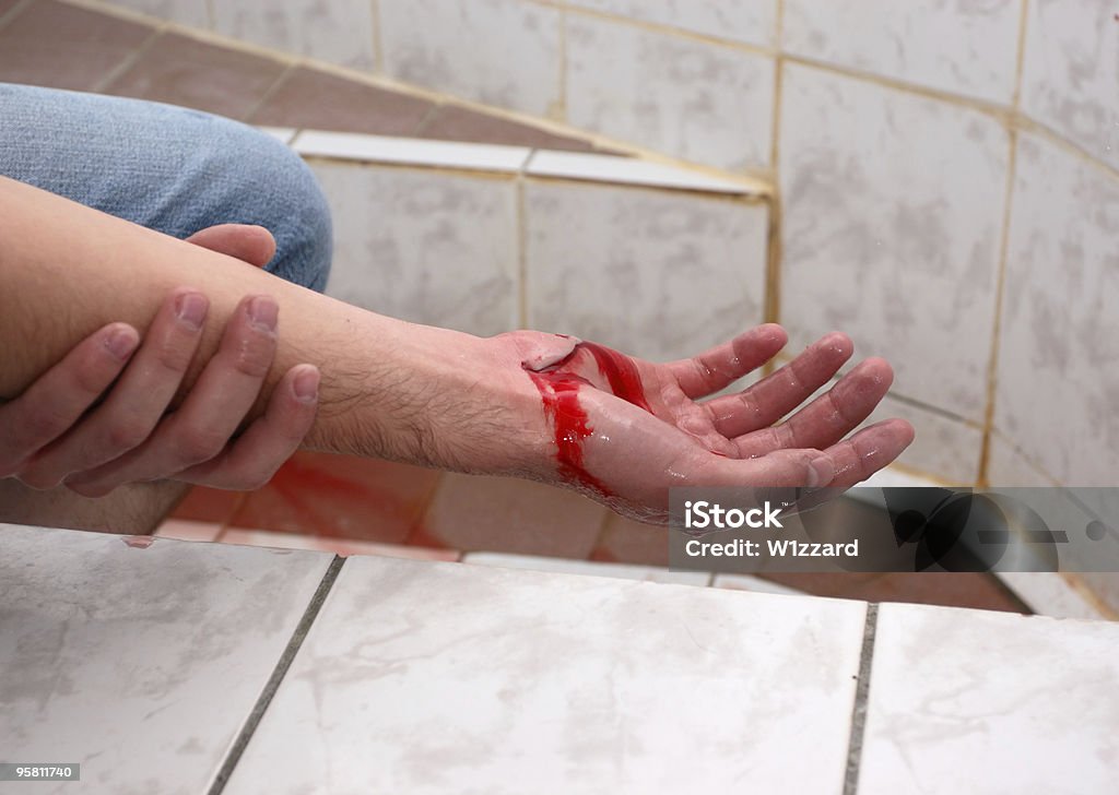 Heridos de mano - Foto de stock de Herida libre de derechos