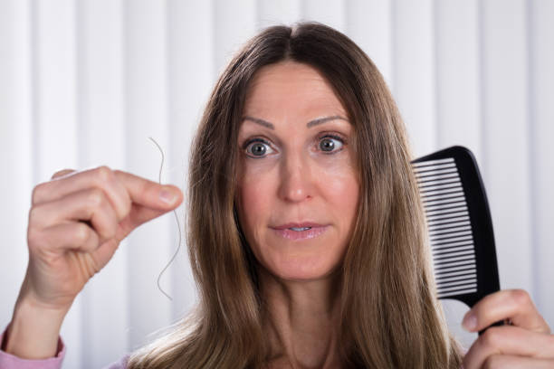 istock Shocked Woman Losing Hair 958335936