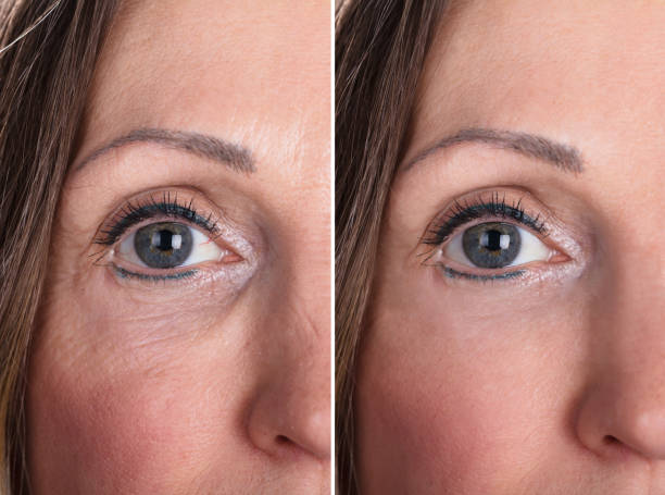 istock Woman With Before And After Rejuvenation 958340298