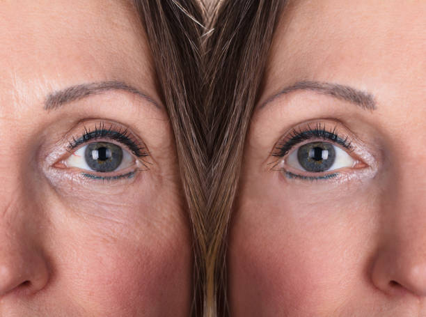 istock Woman With Before And After Rejuvenation 958340330