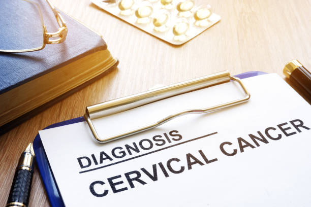 istock Cervical cancer diagnosis on a clipboard. 958495918