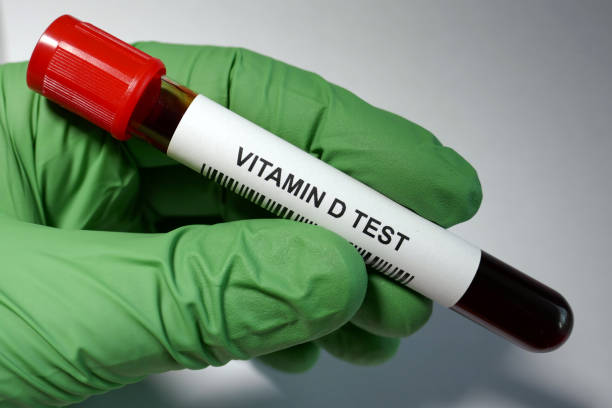 Vitamin D Blood Test stock photo