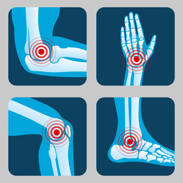 ilustraciones, imágenes clip art, dibujos animados e iconos de stock de articulaciones humanas con anillos de dolor. infografía de artritis y reumatismo. botones de vector de aplicación médica - pain joint human hand arthritis