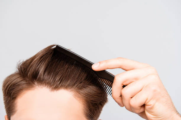 Close Up Photo Of Clean Healthy Mans Hair Without Furfur Stock Photo -  Download Image Now - iStock