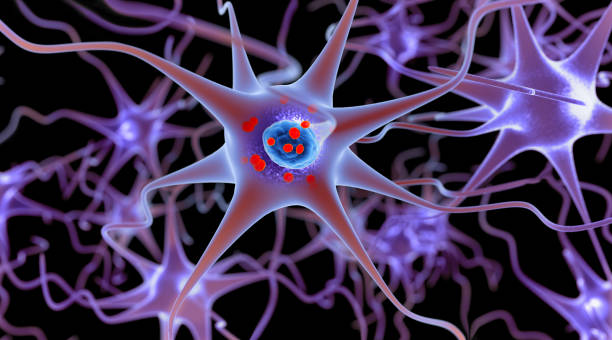 Parkinson's disease. 3D illustration showing neurons containing Lewy bodies small red spheres which are deposits of proteins (alpha-synuclein) accumulated in the brain cells. Parkinson's disease. 3D illustration showing neurons containing Lewy bodies small red spheres which are deposits of proteins (alpha-synuclein) accumulated in the brain cells. dopamine stock pictures, royalty-free photos & images