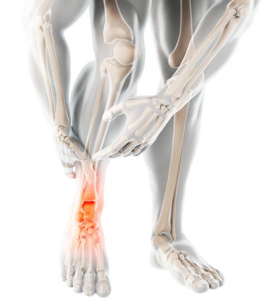 istock Ankle painful - skeleton x-ray. 958981504