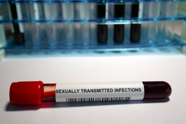 screening delle malattie veneree - sexually transmitted disease foto e immagini stock