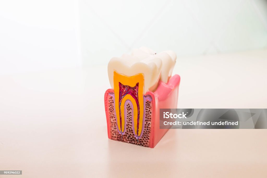 Zahn-Modell ohne Karies, Karies in Zahnarztpraxis. Gesunde Zähne-Konzept. Kinder Zahnarzt. Textfreiraum - Lizenzfrei Endodontie Stock-Foto