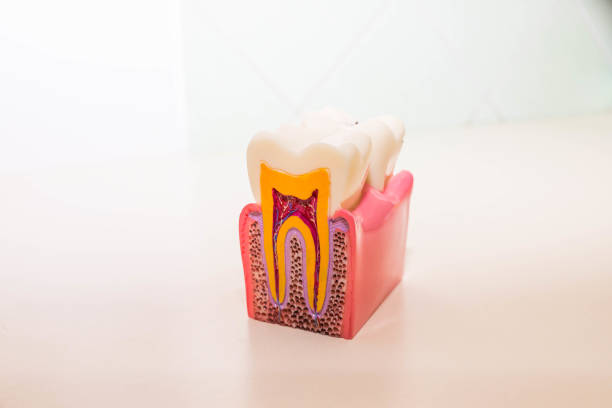 istock tooth model without caries, tooth decay in dentist's office. Healthy teeth concept . children's dentist. Copy space 959296022