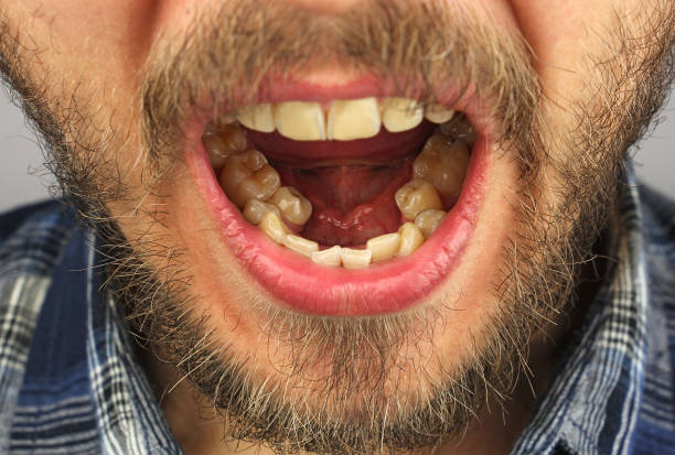 istock man with a beard opened his mouth for dental examination of lowe 959567448