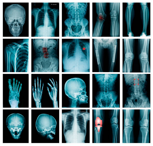 istock collection x-ray image skull, shoulder, hip, knee joint , scoliosis spinne and small joint in content 959604952
