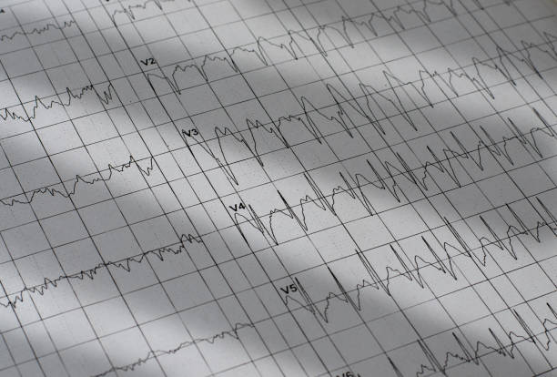 istock Electrocardiogram chart as medical background 959662270