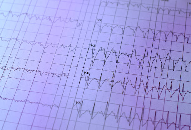 istock Electrocardiogram chart as medical background 959662322