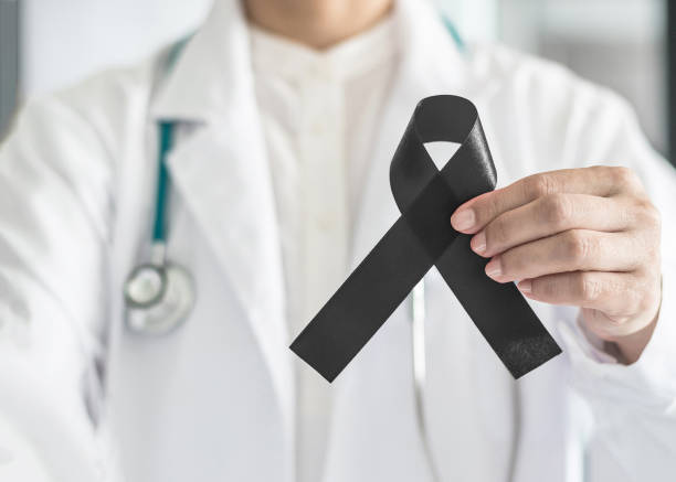 Black ribbon awareness in doctor's hand for Melanoma and skin cancer, Narcolepsy, Primary Biliary Cirrhosis (Cholangitis), Sleep Apnea Disorders Black ribbon awareness in doctor's hand for Melanoma and skin cancer, Narcolepsy, Primary Biliary Cirrhosis (Cholangitis), Sleep Apnea Disorders skin cancer stock pictures, royalty-free photos & images