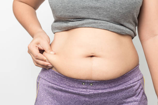 Overweight woman hand pinching excessive belly fat stock photo