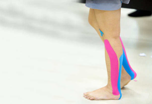 ankle suport by kinesio tapping - kinesio imagens e fotografias de stock