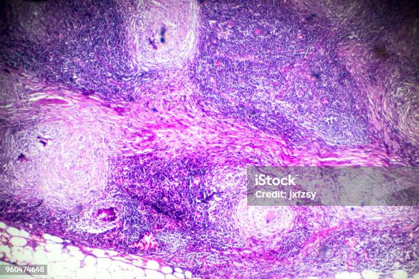 Lymph Node In Microscope Lymph Node Microscope Slide