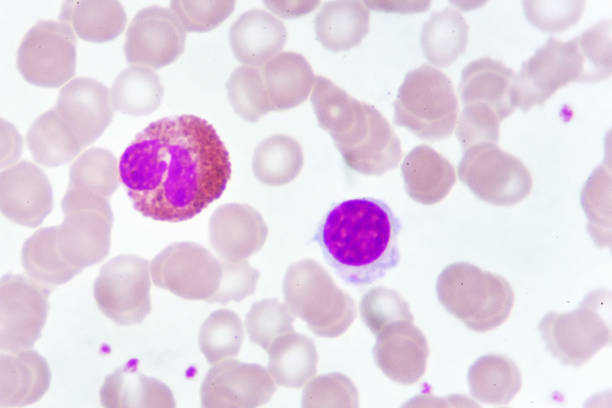 istock White blood cells in blood smear 960552260