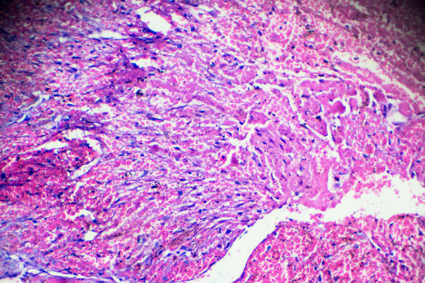 Pathological Problems 240+ Clinic Pathological Stock Photos, Pictures & Royalty-Free Images ...