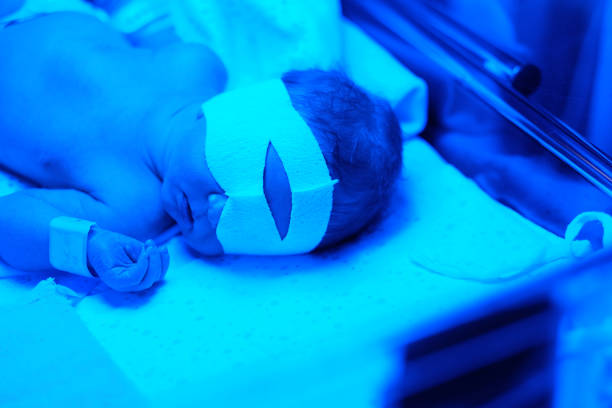 Newborn baby having photo theraphy stock photo