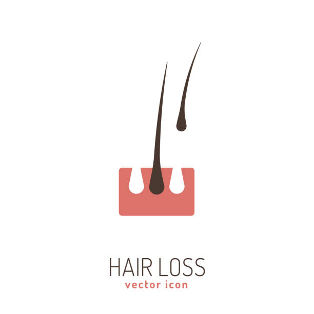 Hair loss icon Hair loss icon. Vector illustration in flat style isolated on a white background. Beauty, dermatology and health care concept in pink and brown colors. papilla stock illustrations