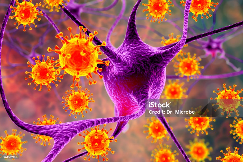 Viren infizieren Neuronen, Konzept für Gehirn-Infektion - Lizenzfrei Meningitis Stock-Foto