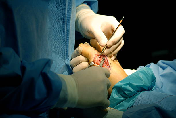 開始を終了 - podiatrist orthopedic surgeon podiatry surgical equipment ストックフォトと画像