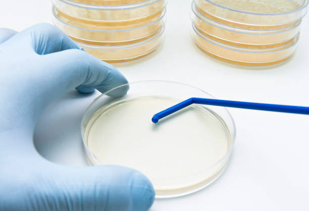 istock A researcher spreads bacterial cells on the agar plate using a disposable spreader 961799824