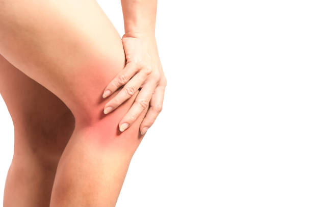 knee sprain stock photo