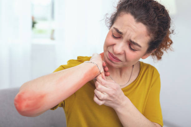 istock Young woman inspecting her sore arm 961894468