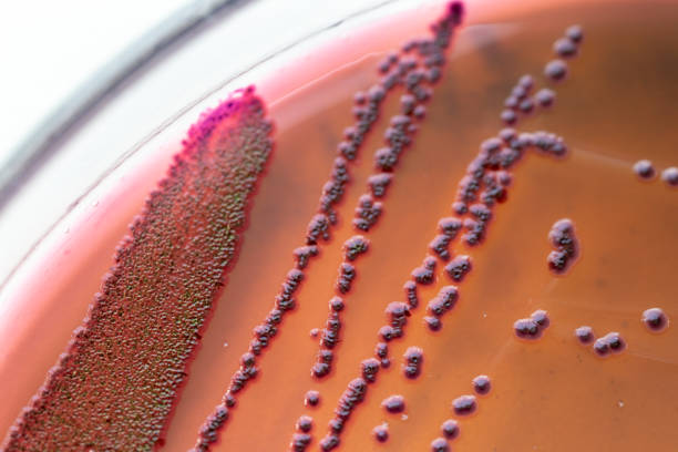 colonies caractéristiques de escherichia coli (e. coli) est une bactérie gram négative anaérobie facultatives, en forme de bâtonnet, coliforme du genre escherichia que l'on trouve couramment dans le gros intestin. - growing medium photos et images de collection