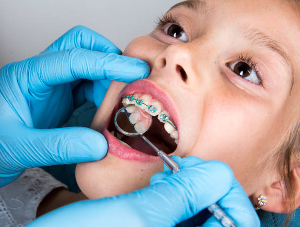 Dentist examining back of little girl teeth with dental mirror Dentist examining back of a little girl patient's teeth with green braces using concave mirror. Close up of girl head and dentist hands in blue gloves concave stock pictures, royalty-free photos & images