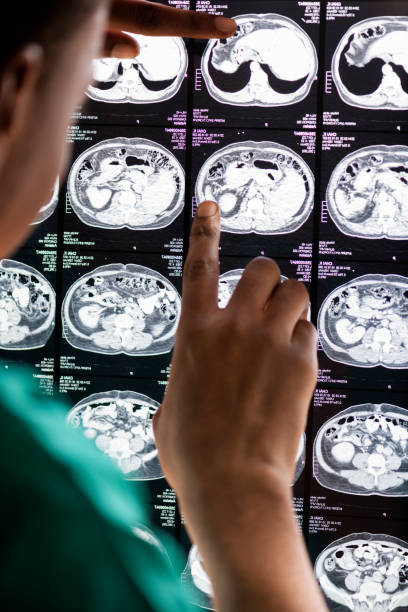 medico che legge il risultato della risonanza teste di radiografia del cervello - doctor brain x ray x ray image foto e immagini stock