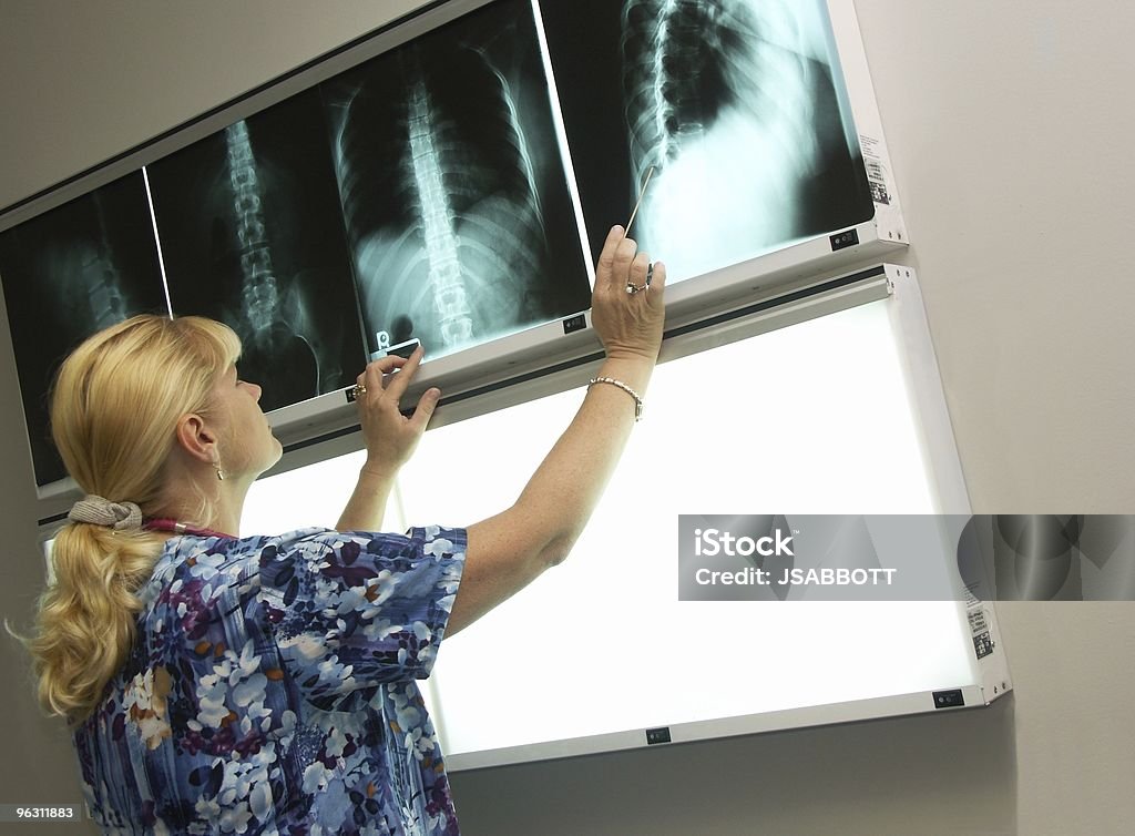 X-Ray tecnico - Foto stock royalty-free di Radiografo