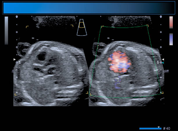 istock Identical twin boy obstetrical ultrasound 963176368