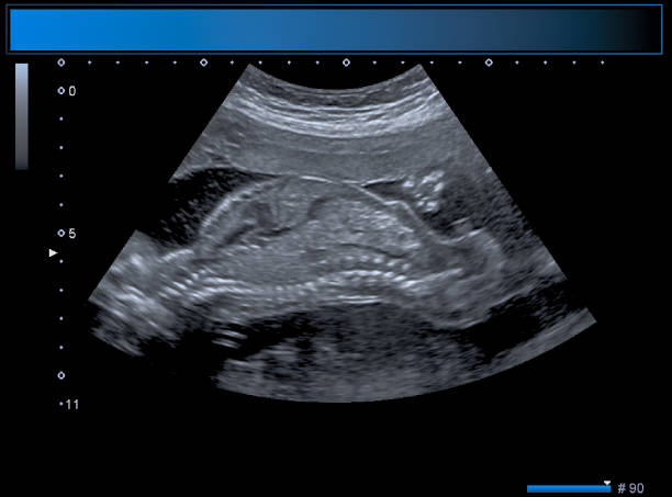 istock Identical twin boy obstetrical ultrasound 963176560