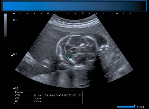 istock Identical twin boy obstetrical ultrasound 963176624