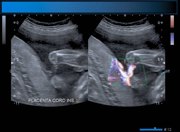 istock Identical twin boy obstetrical ultrasound 963194922