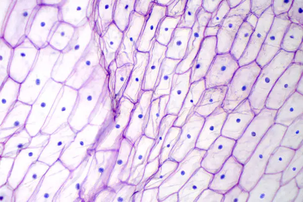 Photo of Onion epidermis with large cells under microscope