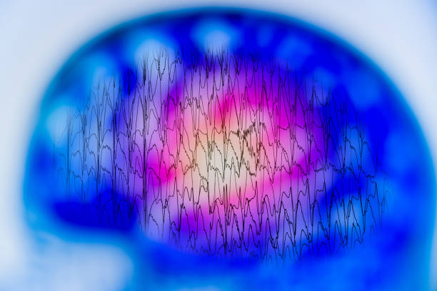 eeg con actividad eléctrica anormal del cerebro, electroencefalograma, eeg - onda cerebral fotografías e imágenes de stock