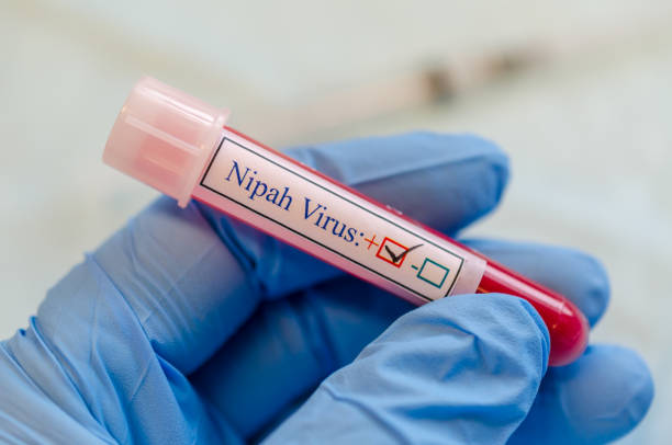Nipah virus positive blood sample stock photo