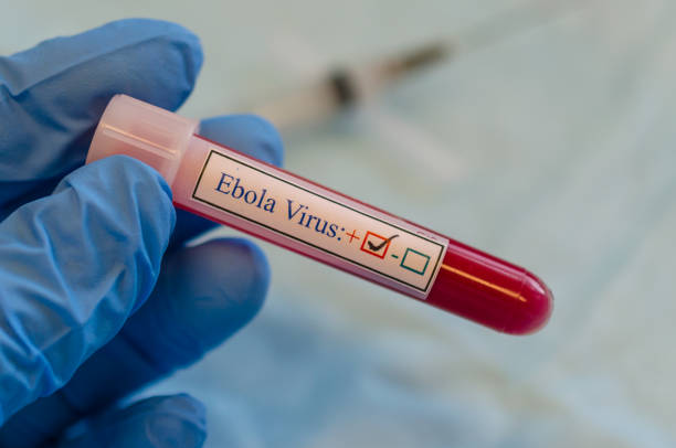 ebola-virus-positivem blut - krankheitsvektor stock-fotos und bilder