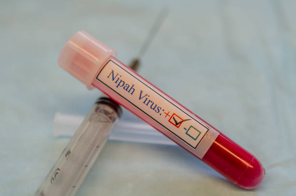 Tube contain Nipah virus positive blood sample stock photo