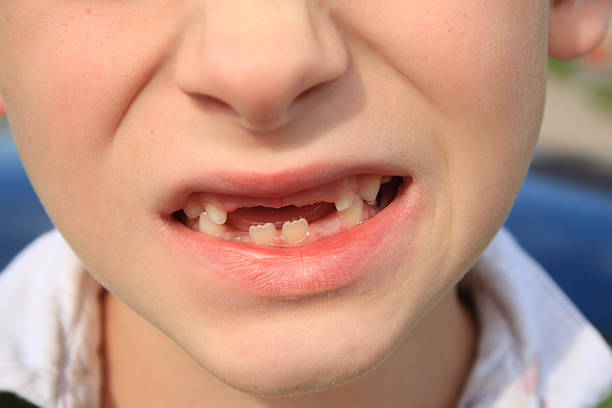 istock gaps between his teeth - waiting for new to grow 96360156