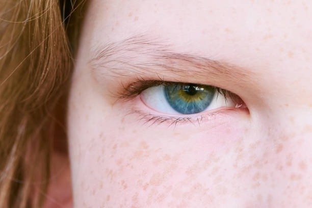 istock girl eye close up 963818196