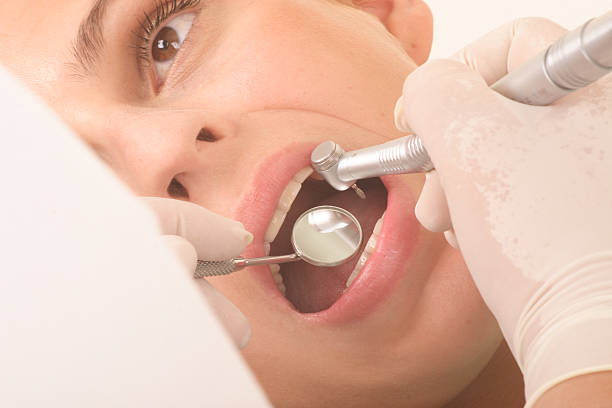 istock At the dentist - close up 96396910
