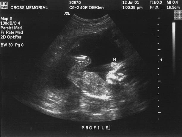 Baby Ultrasound stock photo