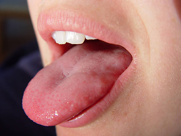 istock Open mouth with stick out tongue 96399947