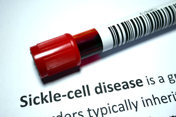 Sickle cell anemia Sickle-cell disease - blood disorder abstract. sickle cell stock pictures, royalty-free photos & images