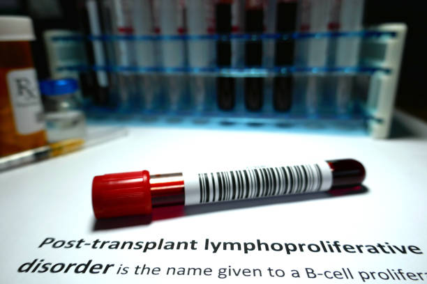 Post-transplant lymphoproliferative disorder Post-transplant lymphoproliferative disorder - blood disorder abstract. Recombinant Antihemophilic Factor stock pictures, royalty-free photos & images